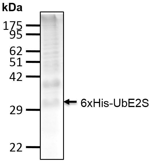 Recombinant Human Polyubiquitinated UbE2S protein