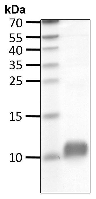 Recombinant Human Ubiquitin(1-75) protein