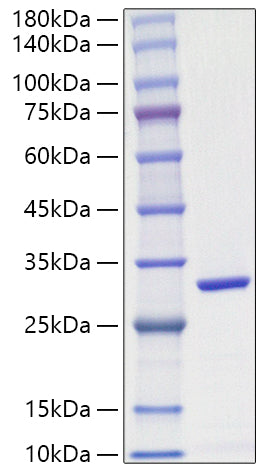 Recombinant Schistosoma japonicum GST Protein