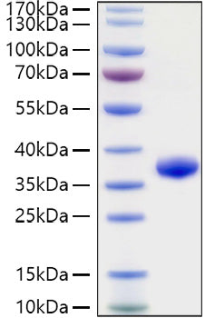 Recombinant Human IgG4 Protein