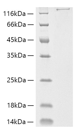 Recombinant Streptococcus pyogenes M1 Cas9 Protein