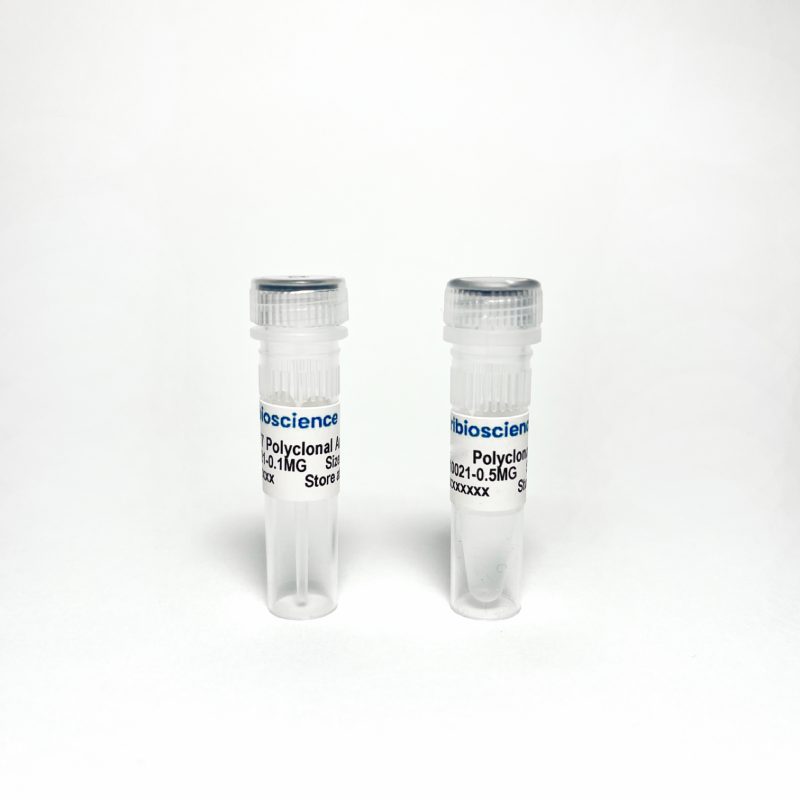Phospho-Tau Thr181 (p-tau181) Polyclonal Antibody Validated as capture in ELISA