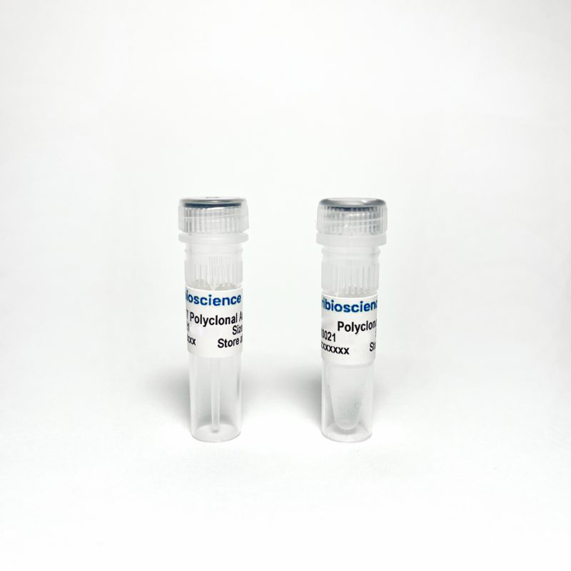 HADHA Rabbit Polyclonal Antibody
