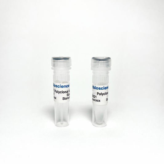 HADHA Rabbit Polyclonal Antibody