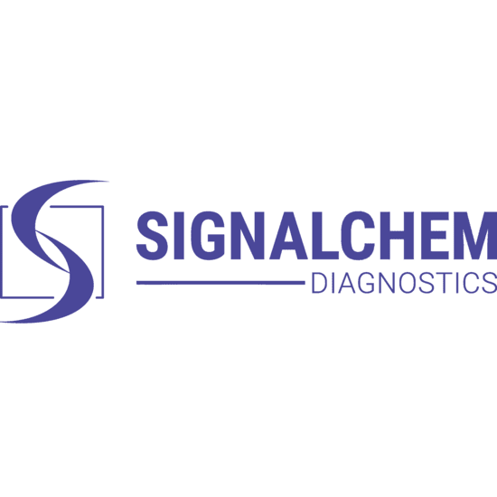 2019-nCoV S1 Human IgM ELISA Kit