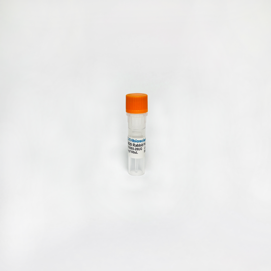 RBM20 Rabbit Polyclonal Antibody