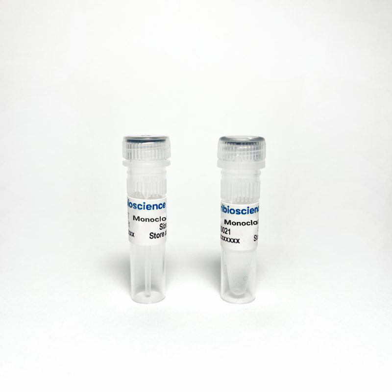 E2F1 Rabbit Monoclonal Antibody (TBS10265) - 100 uL