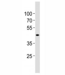 Western blot analysis of lysate from human kidney tissue lysate using SOX7 antibody diluted at 1:100