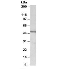 Western blot testing of Daudi lysate with CHIT1 antibody at 1ug/ml. Predicted molecular weight: ~52k