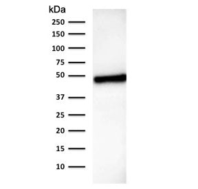 Cytokeratin 18 Antibody