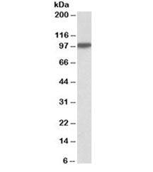 Western blot testing of human liver lysate with Aconitase 1 antibody at 0.1ug/ml. Predicted molecula