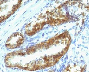 PSA / Prostate Specific Antigen Antibody