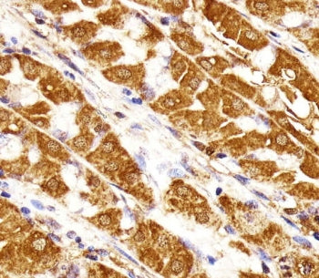 IHC testing of FFPE human stomach tissue with Nuclear matrix protein 2 antibody. HIER: steam section