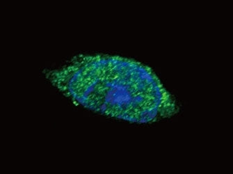 Confocal immunofluorescent analysis of JAK2 antibody with HeLa cells followed by Alexa Fluor 488-con