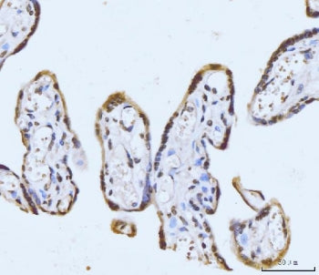 IHC staining of FFPE human placental tissue with GHITM antibody. HIER: boil tissue sections in pH8 E