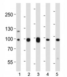 Ephb1 Antibody