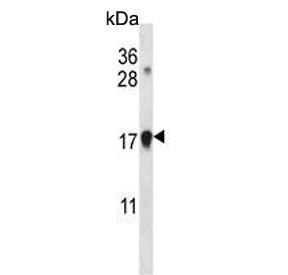 p21 Antibody / CDKN1A