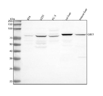 Western blot analysis of GBE1 using anti-GBE1 antibody. Lane 1: human RT4 whole cell lysates, Lane 2