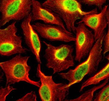Immunofluorescent staining of SIPA1 using anti-SIPA1 antibody (green) and anti-Beta Tubulin antibody