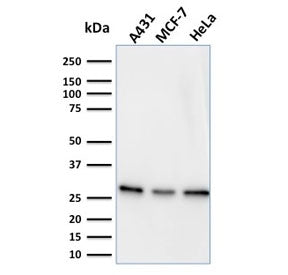Myofibroblast Antibody