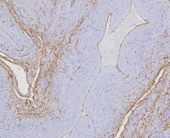 IHC staining of FFPE human uterus tissue with CD34 antibody (clone HPCA1/8353R). HIER: boil tissue s