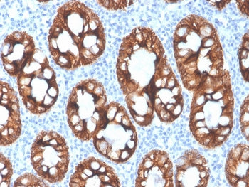KRT8 Antibody / Cytokeratin 8