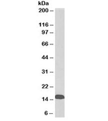 Western blot testing of human albumin-depleted serum with TTR antibody at 0.03ug/ml. Predicted molec