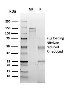 S100A2 Antibody