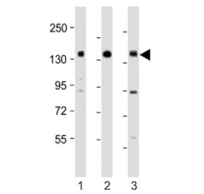 Western blot testing of RON antibody at 1:1000: Lane 1) human HACAT, 2) HCT116 and 3) SK-BR-3 cell l