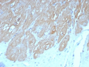 FABP3 Antibody