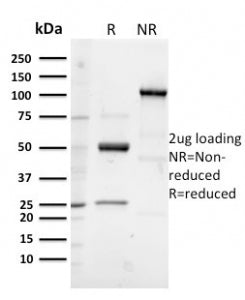 Glycoprotein 2 Antibody / GP2 / ZAP75
