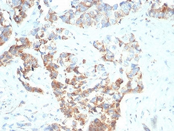 BCMA Antibody / CD269 / TNFRSF17