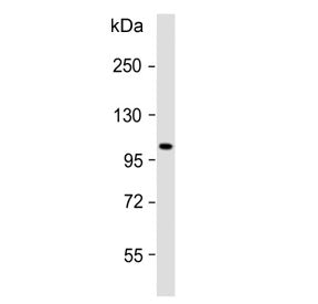 Western blot testing of human skeletal muscle lysate with ATP1A2 antibody. Predicted molecular weigh