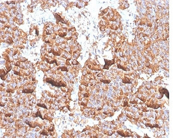 Prolactin Antibody / PRL