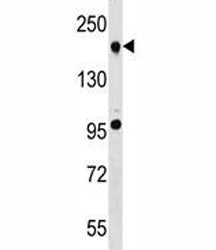 TET2 Antibody