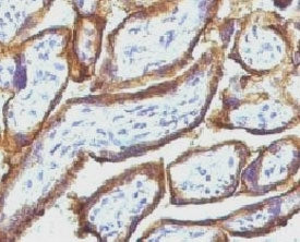 EGF Receptor / EGFR Antibody