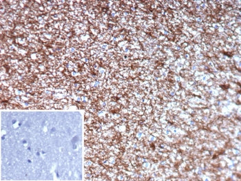 IHC staining of FFPE human brain tissue with GFAP antibody (clone GFAP/9422). Inset: PBS used in pla