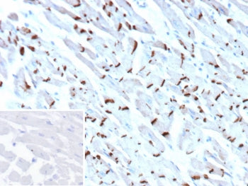 IHC staining of FFPE human heart tissue with Cadherin 2 antibody (clone CDH2/9493). Inset: PBS used 