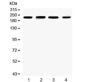 Western blot testing of human 1) K562, 2) HL60, 3) HEK293 and 4) PC-3 cell lysate with Ch-TOG antibo