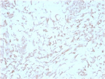 Kindlin 2 Antibody / KIND2
