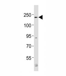 Alk Antibody