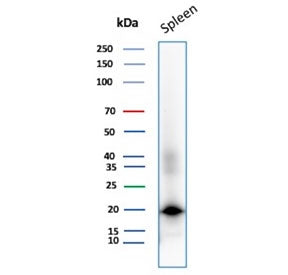 Western blot testing of human spleen tissue lysate with Stathmin 1 antibody. Expected molecular weig