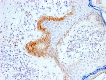 IHC testing of FFPE human skin with recombinant Cytokeratin 15 antibody (clone KRT15/2103R). Require
