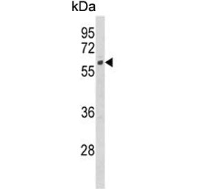 Western blot testing of human HeLa cell lysate with CYP7B1 antibody. Predicted molecular weight ~58 