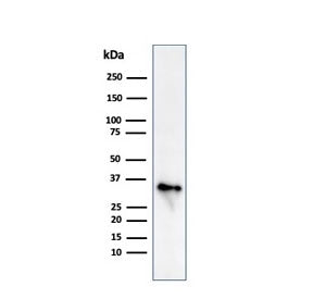 CD74 / CLIP Antibody