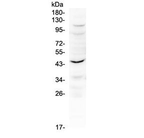 Il12 p40 / Il-12b Antibody