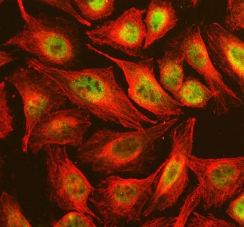 Immunofluorescent staining of FFPE human U-2 OS cells with NSMCE2 antibody (green) and Beta Tubulin 