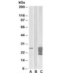 Western blot of HEK293 lysate overexpressing human GM2A-FLAG probed with GMA2 antibody (1ug/ml) in L