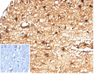 IHC staining of FFPE human brain tissue with recombinant Aldehyde Dehydrogenase 1A1 antibody (clone ALDH1A1/7011R). Negative control inset: PBS instead of primary antibody to control for secondary binding. HIER: boil tissue sections in pH 9 10mM Tris with 1mM EDTA for 20 min and allow to cool before testing.