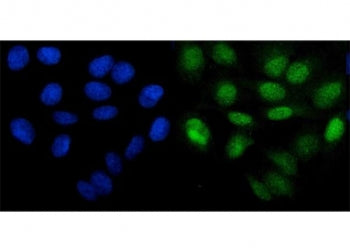 Immunofluorescent staining of FFPE human U-2 OS cells with PHF21B antibody (green) and DAPI nuclear 